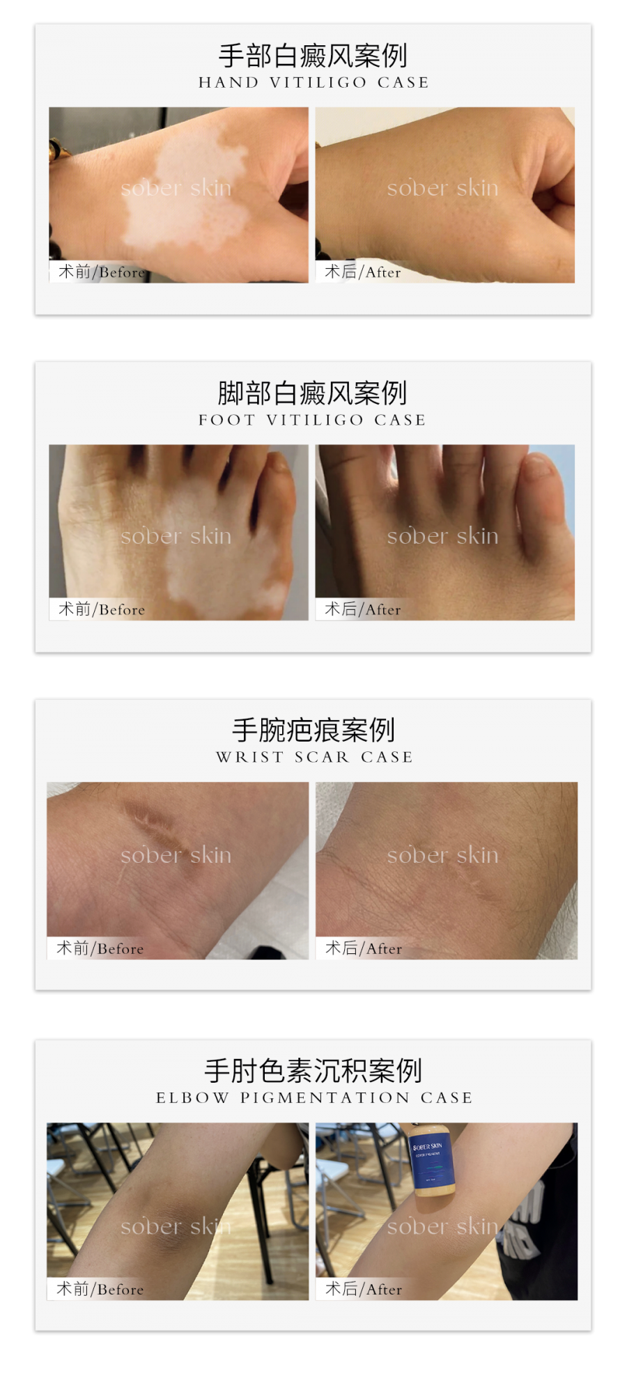 姝蓓尔肤色重建案例展示图片6